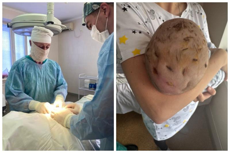 Гнійна інфекція в області голови ставила під загрозу життя тримісячного малюка. Медики здійснили екстрене хірургічне втручання, яке тривало всього 20 хвилин.